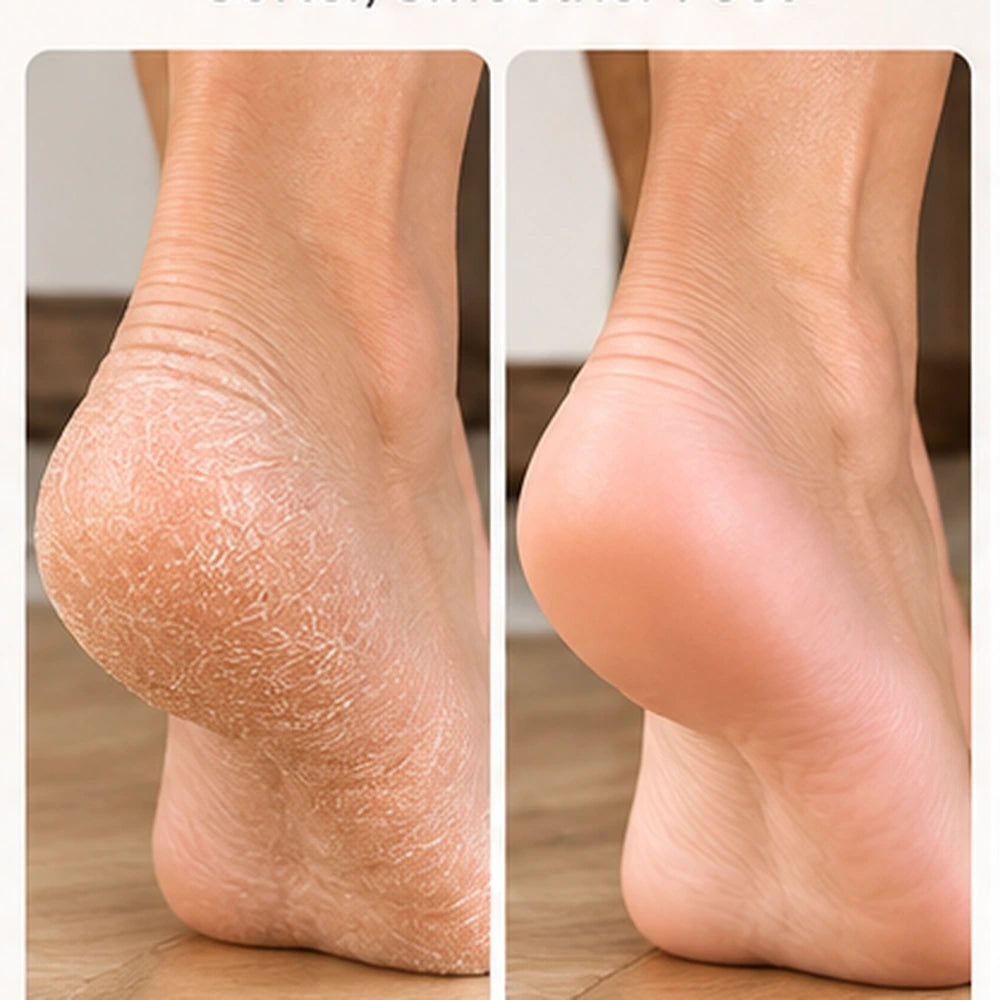🔥LAST DAY SALE! 50% OFF!🔥Electric Callus Remover for Softer, Smoother Feet